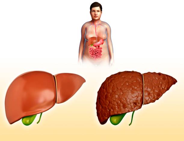 integratori per fegato grasso