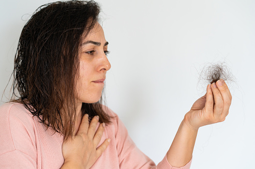 Integratori naturali per combattere la caduta dei capelli nelle donne